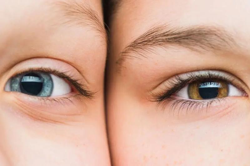 Boja očiju kod beba – Kako se nasleđuje boja očiju?
