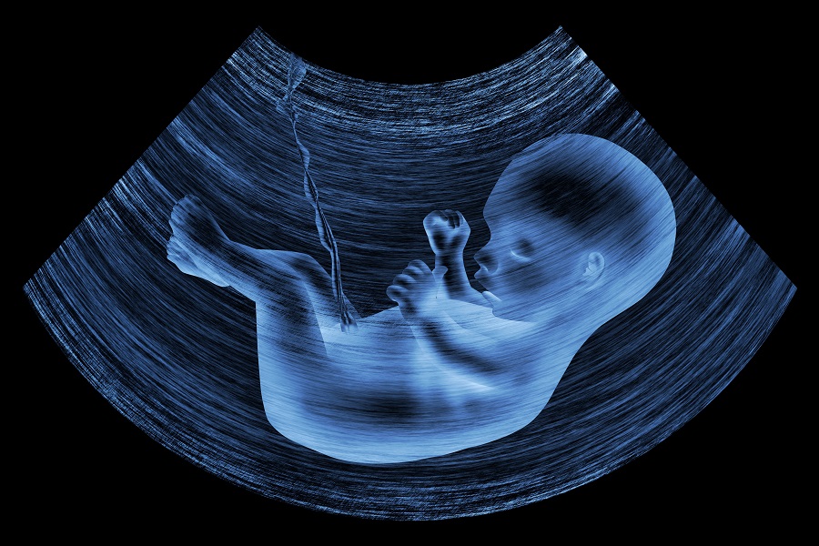 Koje sve anomalije ploda u trudnoći postoje?